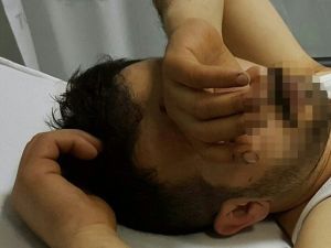 Pavyonda Bıçaklandı