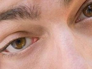 Gözler Vücudun Aynasıdır