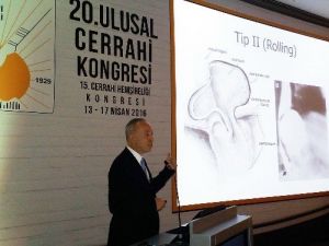 Reflüde Laparoskopik Cerrahi