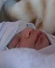 Bebek sallama sendromu