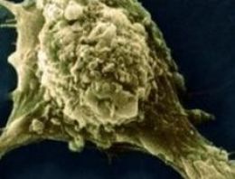 Kanser için korkutan açıklama!