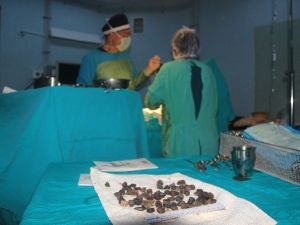 Mide Değil Taş Ocağı