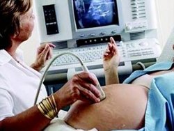 Kısırlıkta bazen ilk ve tek çare tüp bebek