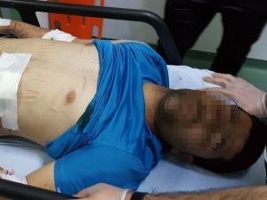 Asker Eğlencesinde 3 Kişi Hastanelik Oldu