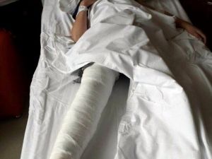 Parkta Salıncaktan Düşen Çocuk Ağır Yaralandı