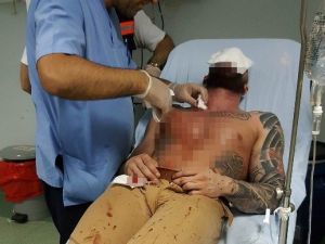 Ev Sahibi Emlakçıyı Falçata İle Hastanelik Etti