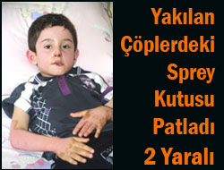 Sprey Kutusu Patladı: 2 Yaralı