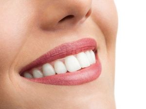 Dijital Diş Hekimliği İle Harika Sonuçlar