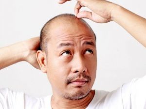 Kelliğe Karşı Saç Klonlama