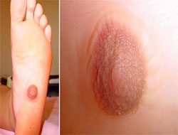 Tıp dünyası böylesini görmedi