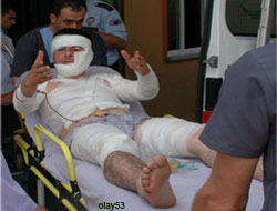 Rize'de Kavga: 5 Yaralı