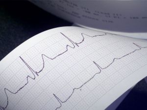 Kalp Hastalarına Oruç Tavsiyeleri