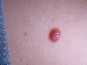 Benlerdeki Bu Değişimlere Dikkat