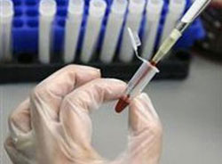 Bu test 14 hastalığı teşhis edecek!