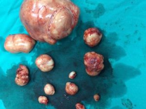 Rahminden 12 Adet Ur Çıktı