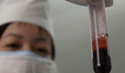 AIDS'te umut verici aşı