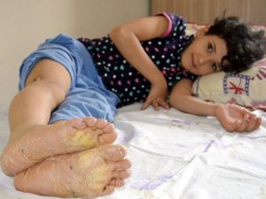 8 Yaşındaki Beyza’nın Hastalığına Teşhis Konulamıyor