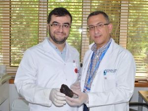 16 Yaşındaki Kızın Midesinden 190 Gram Taş Çıktı