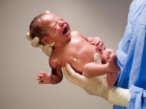 Riskli Bebeklerde Erken Müdahale Yaklaşımları