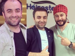 Kelliğin Saça “U” Dönüşü