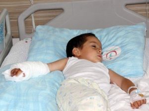 Küçük Hasan’ın Kopan Parmağı Dikildi