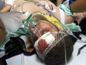 Samsun’da Maganda Kurşunu Kameramana İsabet Etti