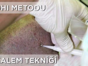 Daha Sık Saçlar İçin Kalem Tekniği