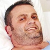 Vücudunda 5 böbrek var