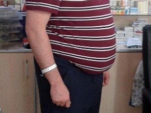 Tüp Mide Ameliyatıyla Diyabetten Kurtuldu