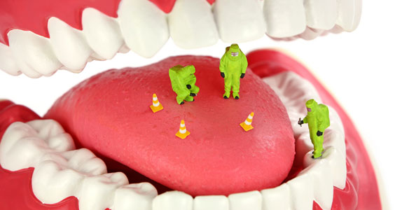 Ağız kokusu nasıl önlenir?