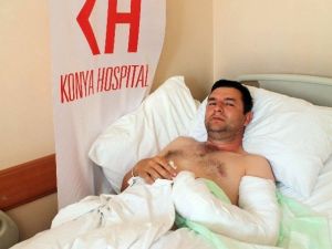 İş Kazasında Kesilen Kolu Dikildi