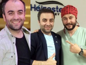 Sönmez: “Saç Ekiminde 2. Seans Şart Değil”