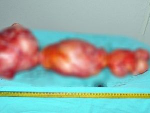 Tıp Literatürüne Geçecek Vaka