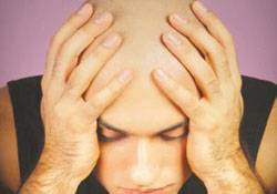 Erkeklerde Kelliğin Nedeni Belli Oldu!