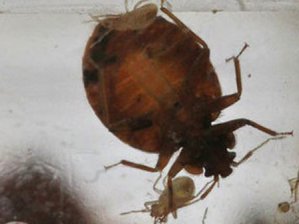 Bakterilerin En Sevdiği Yer!