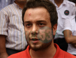 Aniden Sinirlenip Dövdüm !