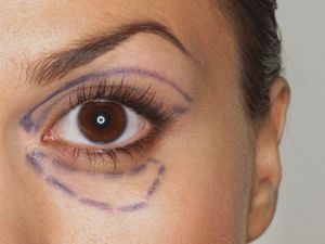 Göz Çevresi Sorunları Yaşlı Gösteriyor