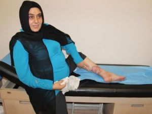 Bacaklarını Kaybetme Korkusu Yaşayan Kadın, Radyo Frekans Yöntemiyle Sağlığına Kavuştu