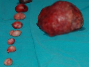 Rahminden 11 Tane Miyom Çıkarıldı