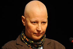 Kemoterapi kabus olmaktan çıkıyor