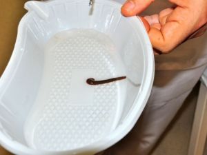 Yaşlı Kadının Burnundan Sülük Çıktı