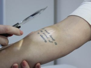 "Dövme Kansere Yol Açabilir"