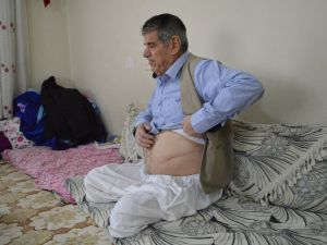 45 Yıllık Sigara Bağımlısının İbretlik Hikayesi