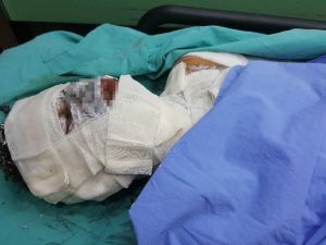 Sobaya Dökülen Tiner Hastanelik Etti