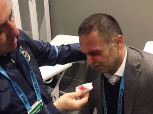 Hasan Çetinkaya’nın Kafası Yarıldı