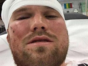 Grosskreutz İle Yolları Ayrılıyor