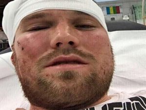 "Grosskreutz’u Hastanelik Eden 16 Yaşında Bir Türk"