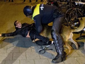 Hollanda Polisinin Köpekli Saldırısında Yaralanan Türk Konuştu