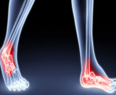 Bilim adamlarından suni kemik müjdesi