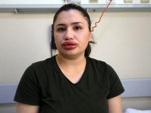 Slikon Mağduru Hemşire Konuştu: Çok Korkuyorum